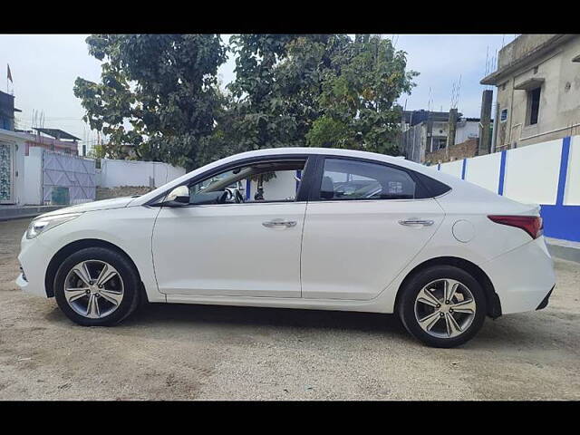 Used Hyundai Verna [2017-2020] SX (O) AT Anniversary Edition 1.6 VTVT in Siliguri